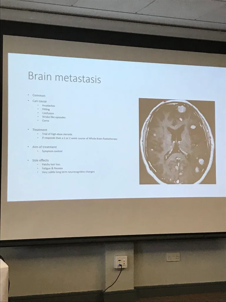 A conference slide on brain metastasis, beside a head scan showing several bright lesions.