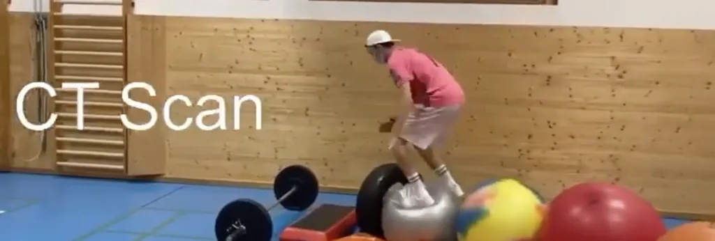 Screentshot from video - illustrating bouncing balls and CT scan