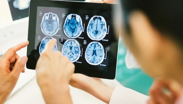 Brain mets